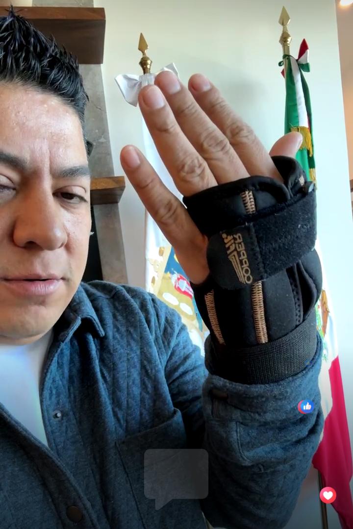 GOBERNADOR SUFRE CAÍDA DE CABALLO 