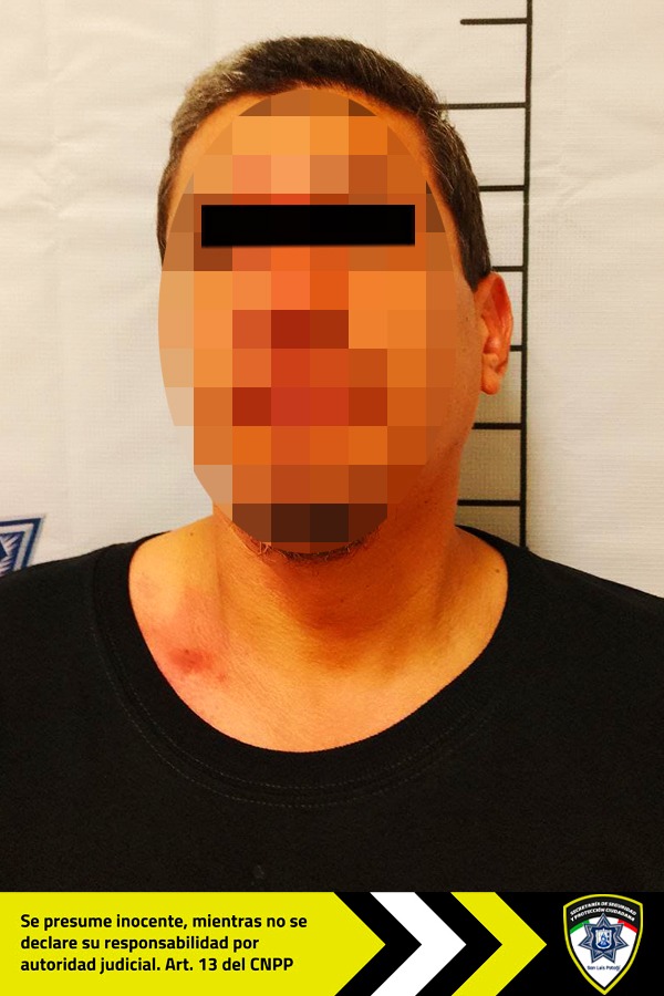 Oficiales de Guardia Municipal detienen a un hombre en zona centro que fue señalado de amenazas y causar&nbsp;lesiones