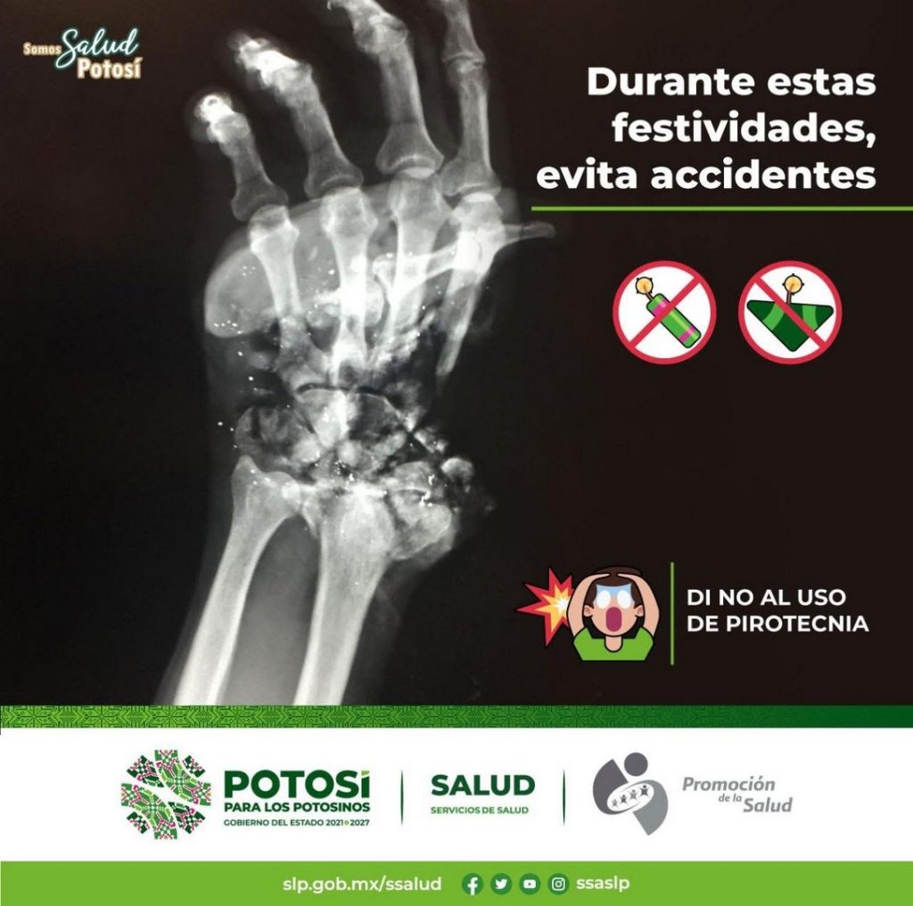 EL ESTADO FORTALECE PREVENCIÓN DE ACCIDENTES POR USO DE&nbsp;PIROTECNIA
