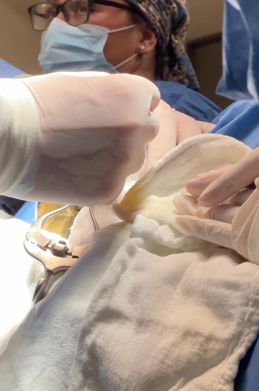 GOBIERNO ESTATAL BRINDA MÁS APOYO A NIÑAS Y NIÑOS CON CIRUGÍAS&nbsp;GRATUITAS