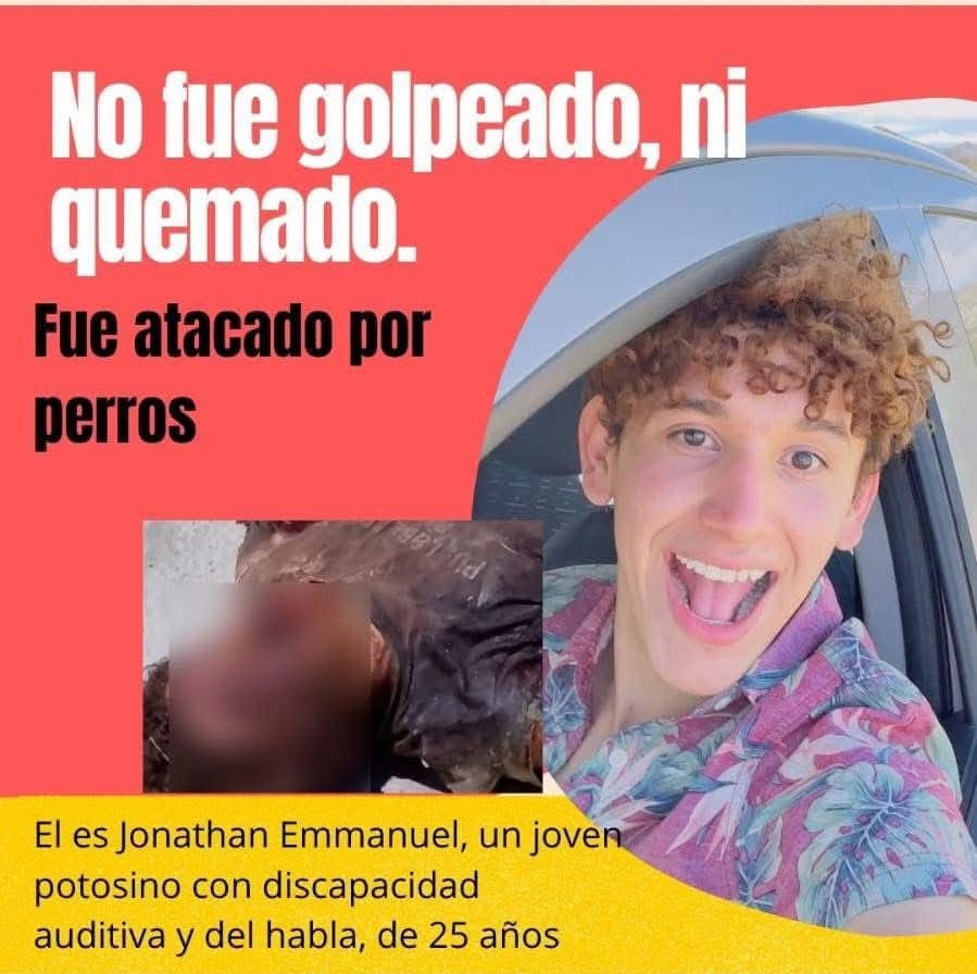 JONATHAN SI FUE ATACADO POR JAURIA DE PERROS EN TERRENOS DE CLINICA&nbsp;50.